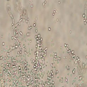 Ruminant Yeast Culture: A Natural Solution for Digestive Health